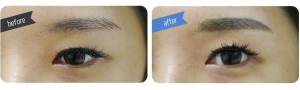 Eyebrow Before & After