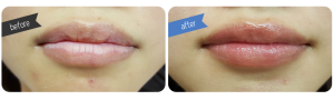 Full Lip Colour Before & After